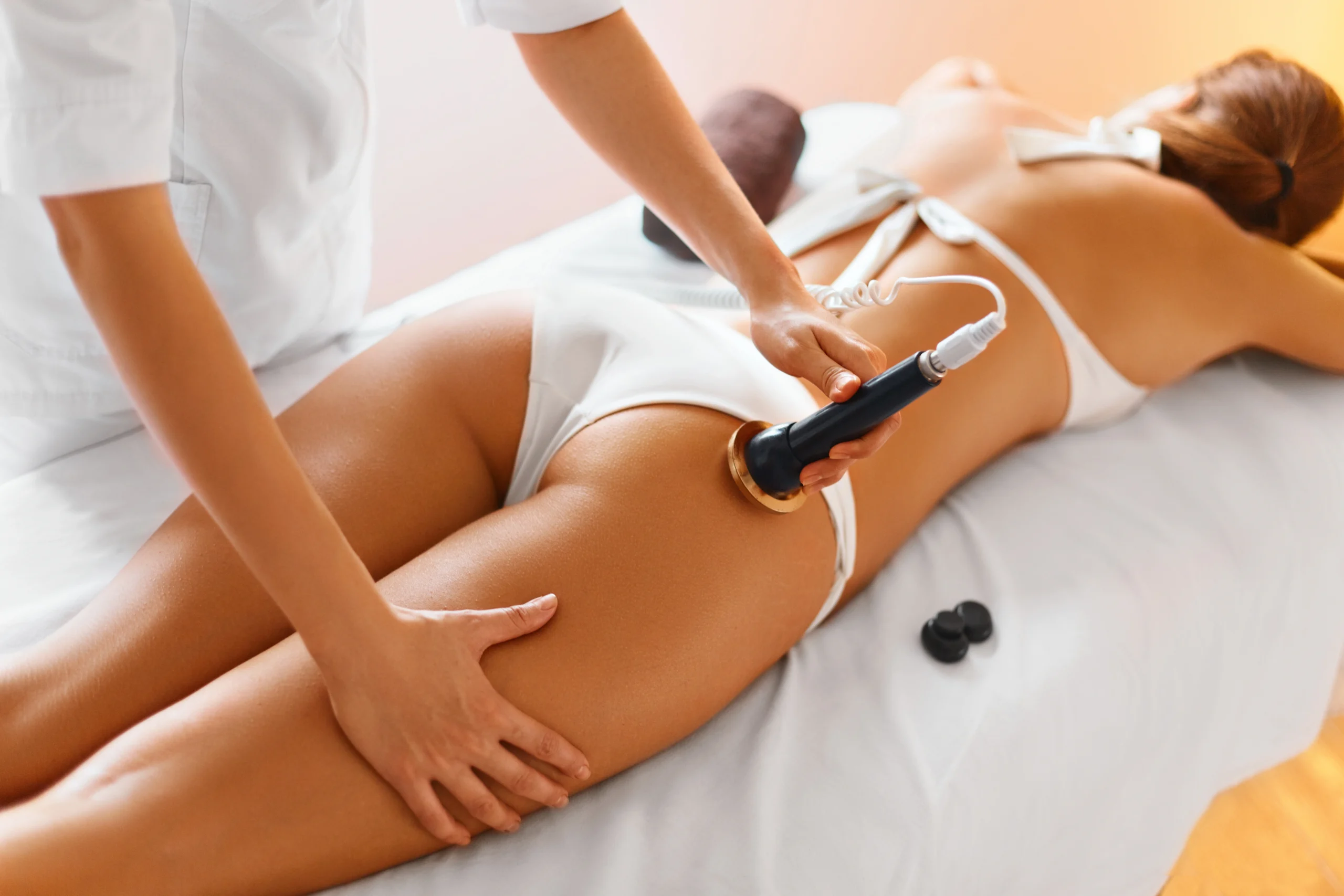 Cellulite Treatment