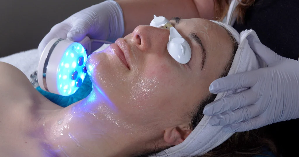 A women getting IPL Treatments in Hammonton