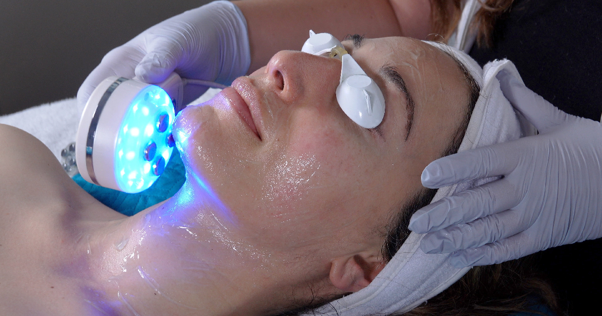 A women getting IPL Treatments in Hammonton