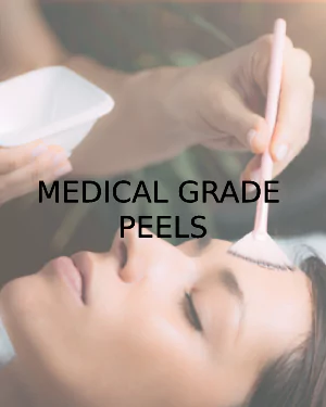 Medical Grade Peels | Awaken Aesthetics