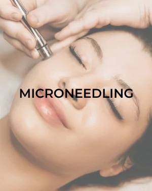 Microneedling | Awaken Aesthetics