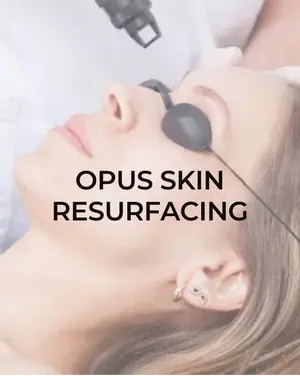 Opus Skin Resurfacing Treatment