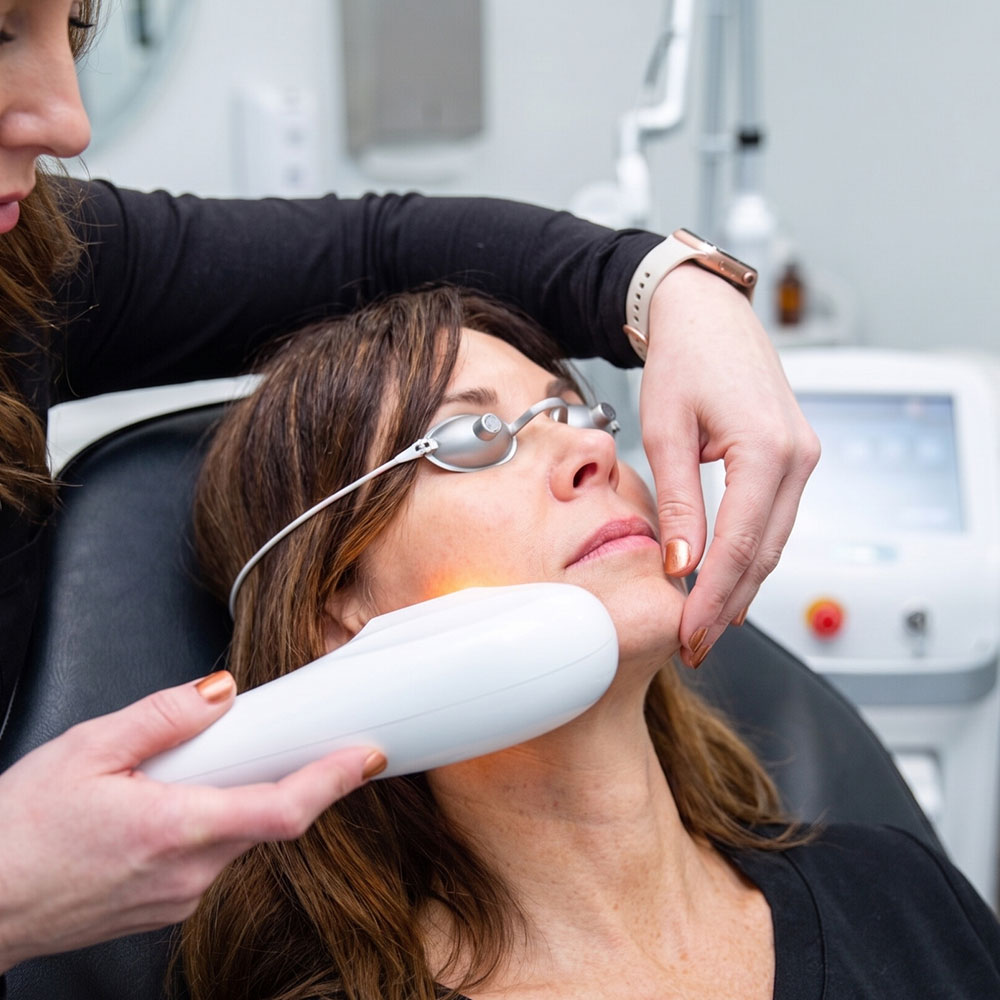 A woman wearing protective goggles receives laser skin treatment on her jawline from an esthetician's handheld device.