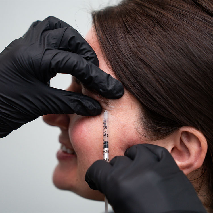 Cosmetic injection: practitioner in black gloves injecting filler into a woman's cheek near the temple