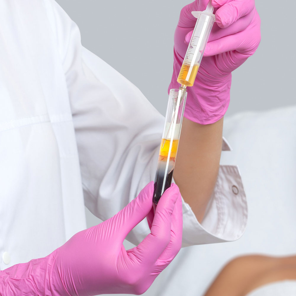A person in pink gloves drawing yellow plasma with a syringe from a blood-filled test tube in a lab.