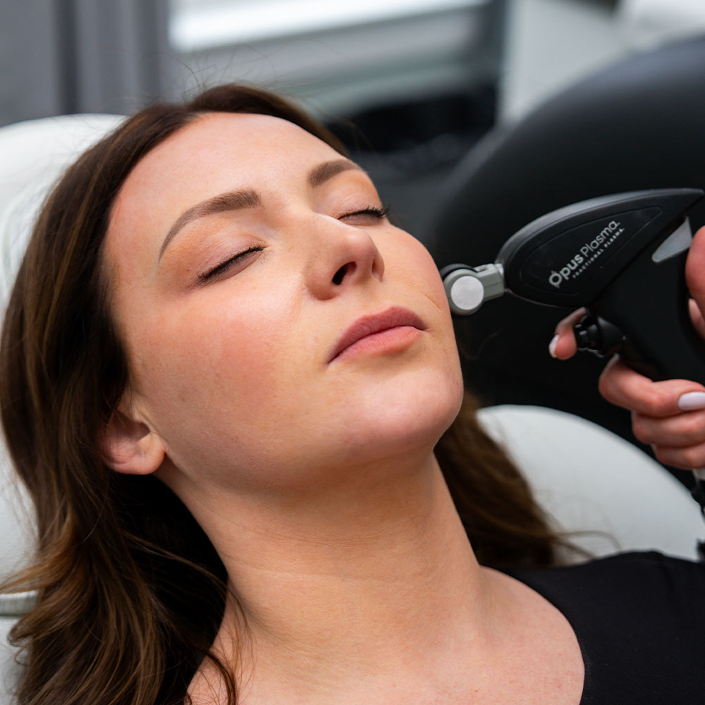 A woman with eyes closed receiving an Opus Plasma cosmetic skin treatment on her cheek