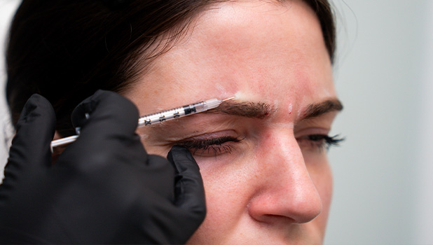 Woman receiving eyebrow injection cosmetic treatment from gloved practitioner, close-up of syringe near brow