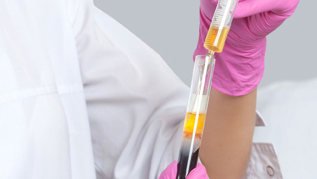 A person in pink gloves pipetting yellow liquid into a test tube with dark liquid